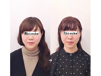 美助(bisuke)/小顔施術のお写真