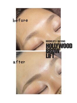 イルス(Ilus)/ハリウッドブロウリフト