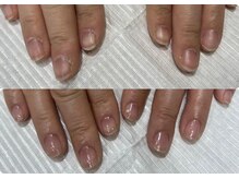 地爪ケアクリニックサロン 松江/乾燥でお悩みのお客様