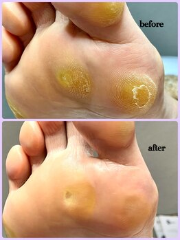 ラヴィ(La vie)/市販では無理でした