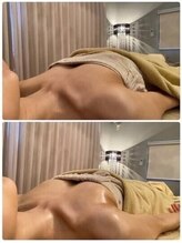 美人バスト 町田店/バストアップ◇症例◇