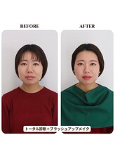 シュアリー(Surely)/トータルコースお客様事例