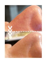 リエイト(Re:eight)/ハイドラ毛穴洗浄