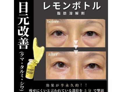 ロゼッティ(ROSETTY)の写真
