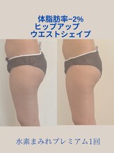 ヨサパーク サンテ 祐天寺(YOSA PARK sante)/痩身/ダイエット/よもぎ蒸し痩身