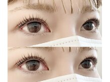 フィーネ ヴァレンテ アルプス通り店/＊施術イメージ＊