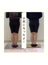 スタイルラボ高松/産後の骨盤矯正の効果♪