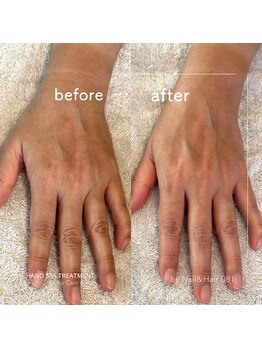 ゼロハチイチ(081)/Hand Spa Treatment