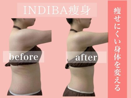 エステサロン ヴリエ 立川店の写真