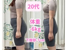 トータルボディーケアステーション 岡山院/20代　耳ツボ　歪み改善