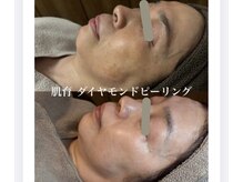エステドルース(esthe de Ruth.)の雰囲気（当店人気【Ruth.オーダーメイドケア】ございます）