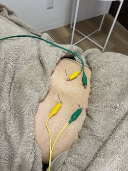 メディカルジャパン 八王子院の写真/不調の根本改善治療院◎肩こり・腰痛などのお悩みから、自律神経の調整や妊活など婦人科系の悩みまで♪