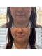 チェックミー(Check me)の写真/期間限定で自信あふれる毎日を。この夏あご下をすっきり整えて理想の自分へ導く！