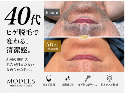 モデルズ 名古屋(MODELS)の写真