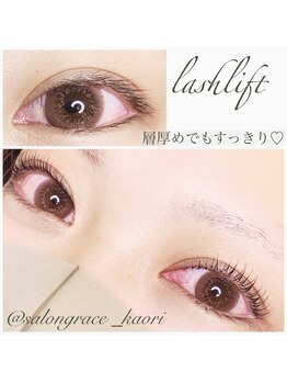 グレイス(grace)/