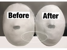 美極 トータルビューティー(美極 TOTAL BEAUTY)/恵比寿/小顔コルギ/エステ/