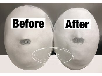 美極 トータルビューティー(美極 TOTAL BEAUTY)/恵比寿/小顔コルギ/エステ/