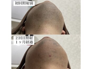 テンパ ビューティー(+10%beauty)/効果写真