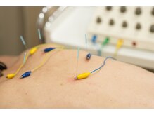 ハーベスト治療院/慢性的な症状には鍼灸も！