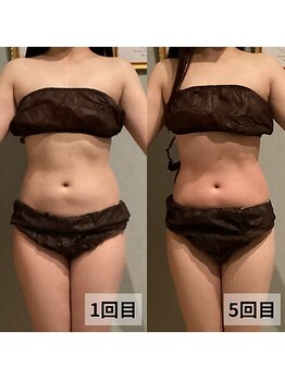 セイリキ(SEIRIKI)/★痩身ダイエットお客様のお声★