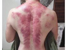 オアシス(OASIS)/ホット★カッサ