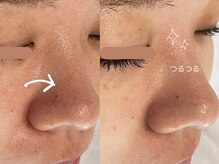 ブルーエム 大森(Blue－M)/