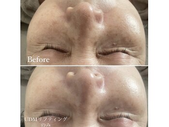 コルギ デ コガオ(KORUGI de KOGAO)/PLAWAVE＊UDMモード