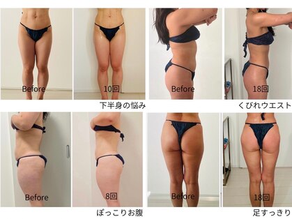 デュモンド(dumonde)の写真