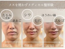 ゴールデンケア(goldencare)の雰囲気(驚愕の変化!悩む必要なくなる!最新コルギとマシン最強コンビ!)