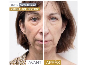 ティーボックスボーテ(TBOX beaute)/