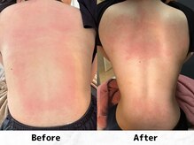 メイヴィ 四日市(Maivi)/20代女性の変化