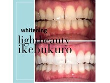 ライトビューティー 池袋店(LightBeauty)