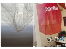 ボディケアルーム ロータス サリの雰囲気（施術回数を重ねるごとに、毒汗の量が増えてきます。）