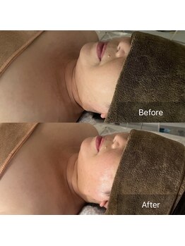 ハートランド(HEARTLAND)/