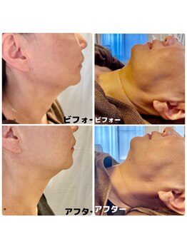 エスサロン(S.salon)/LDM×レモンボトル