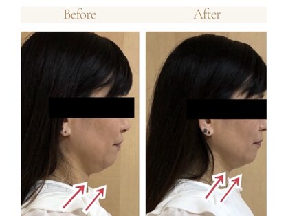 ラディアントミューズ(RadiantMuse)の写真