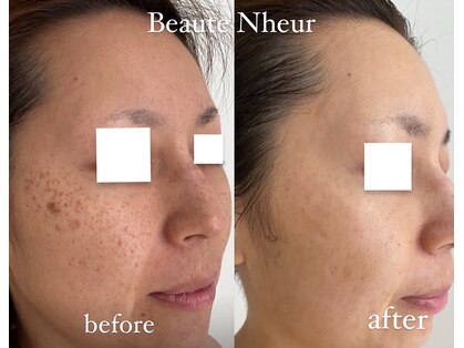 ボーテヌール(Beaute Nheur)の写真