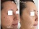 ボーテヌール(Beaute Nheur)の写真