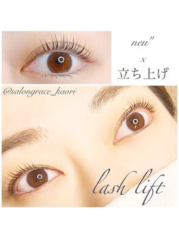 グレイス(grace)/