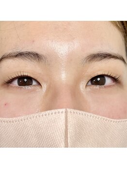 レジアント(Rediant)/一重さんの立ち上げデザイン