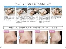 ルミナ(Lumina)/毛穴洗浄ハイドロフェイシャル♪