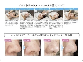 ルミナ(Lumina)/毛穴洗浄ハイドロフェイシャル♪