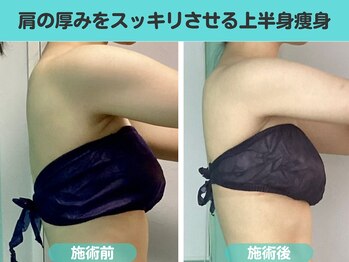 ナナ 銀座(Nana)/肩と背中の厚みをスッキリ