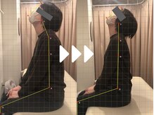 ミライズ整体院 三宮駅前院/事例【30代女性・首こり】