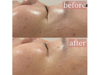 アディクトウラ(Addict'ula)