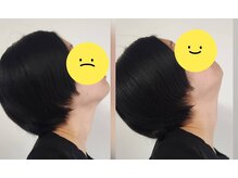 スマイリー(smiley)/首肩にアプローチ