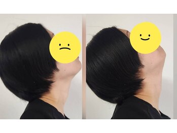 スマイリー(smiley)/首肩にアプローチ