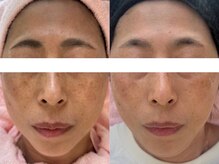 サクラ 本厚木駅前店(SAKURA)/年齢なんて関係ない