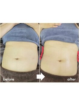 ルミエー(LUMIE)/ハイパーナイフ【1回目】