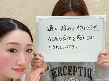 エピア 岡崎店(Epia)/ノーファンデ目指してニキビケア